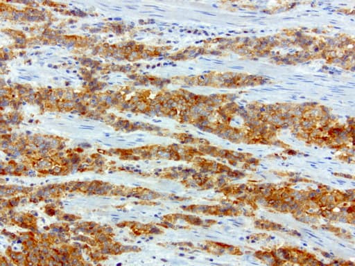 SQSTM1 Antibody (clone UMAB13, Carrier-free)