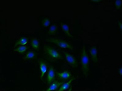 Polyclonal Rabbit anti-Human SLC6A16 Antibody (IHC)