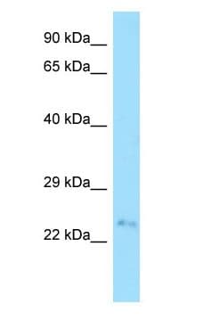 Polyclonal Rabbit anti-Human FAM207A Antibody (N-Terminus, WB)