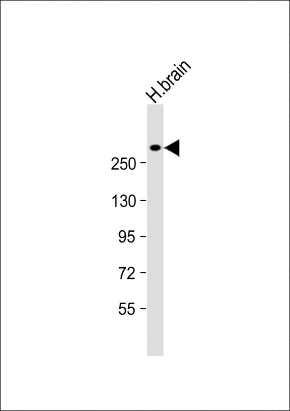 JMJD1C Antibody (C-Terminus)