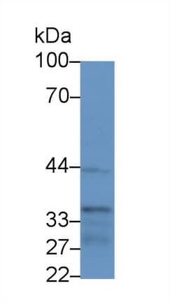 NFKBIB / IKB Beta / IKBB Antibody (aa117-345)