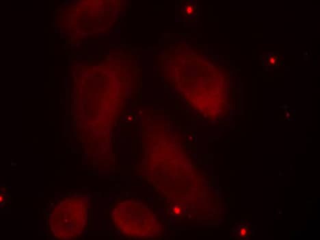 LIMK1 / LIMK Antibody (phospho-Thr508)