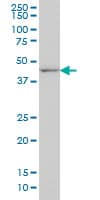IHC-plus™ DLX2 Antibody (clone 2B12)