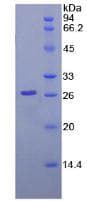 Human LMNB1 / Lamin B1 Protein (Recombinant His-T7)