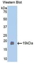 KLB / Beta Klotho Antibody (aa380-506, APC)