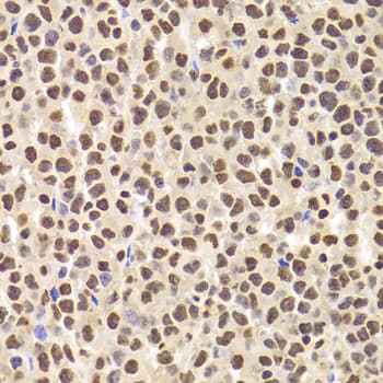 PHAP1 / ANP32A Antibody