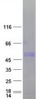 Human LYN Protein (Recombinant Myc-DDK (Flag))