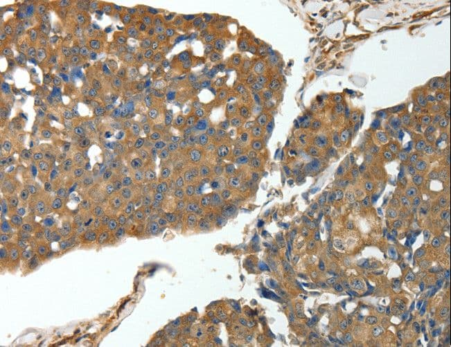 MSN / Moesin Antibody