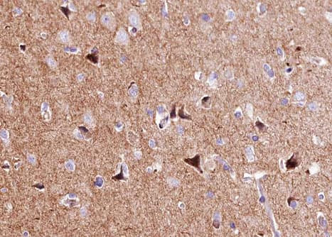 APOE / Apolipoprotein E Antibody
