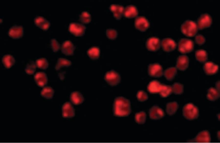 PathPlus™ ACIN1 / Acinus Antibody