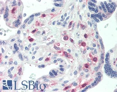 IHC-plus™ GRAB / RAB3IL1 Antibody