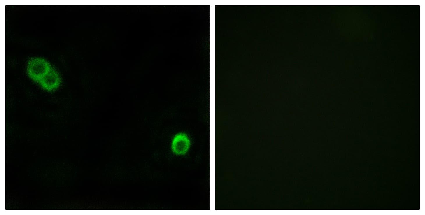 ACER3 Antibody (aa171-220)