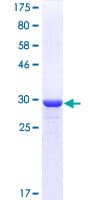 Human GNGT1 Protein (Recombinant GST)