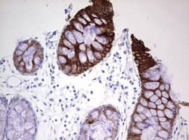 KRT20 / CK20 / Cytokeratin 20 Antibody (clone OTI5F7)