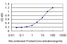 ALDH2 Antibody (clone 1E5)
