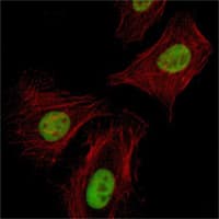 IHC-plus™ RCHY1 / PIRH2 Antibody (clone 1H10)