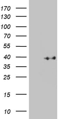 Monoclonal Mouse anti-Human KLF7 Antibody (clone OTI3F6, WB)
