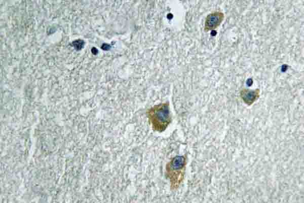 PAK1 Antibody (Lys198)