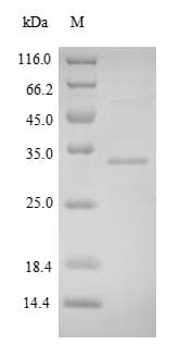 Human FNDC5 / Irisin Protein (Recombinant 6His-SUMO, N-terminus)