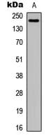 Polyclonal Rabbit anti-Human LAMA4 / Laminin Alpha 4 Antibody (Internal, IHC, IF, WB)