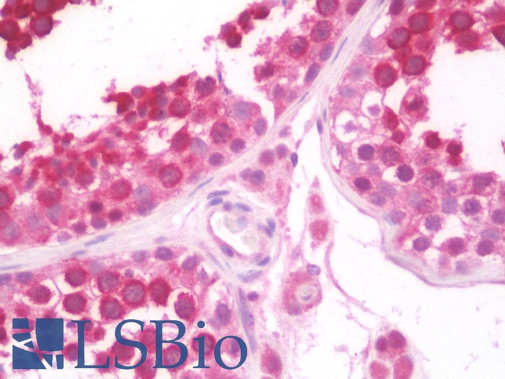 IHC-plus™ LPIN1 / Lipin 1 Antibody