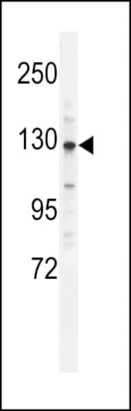 CLIP2 / CYLN2 Antibody (aa911-940)