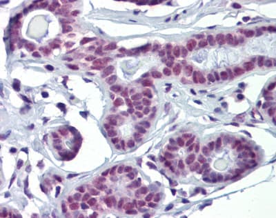 Polyclonal Rabbit anti-Human SOX4 Antibody (N-Terminus, IHC, WB)