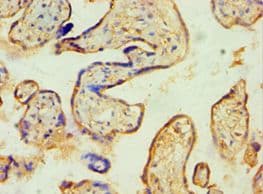 Polyclonal Rabbit anti-Human SPIN2B Antibody (aa1-258, IHC, WB)