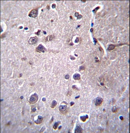 ABRI / ITM2B Antibody (aa218-247)