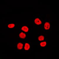 Polyclonal Rabbit anti-Human SMARCC2 Antibody (Internal, IF, WB)