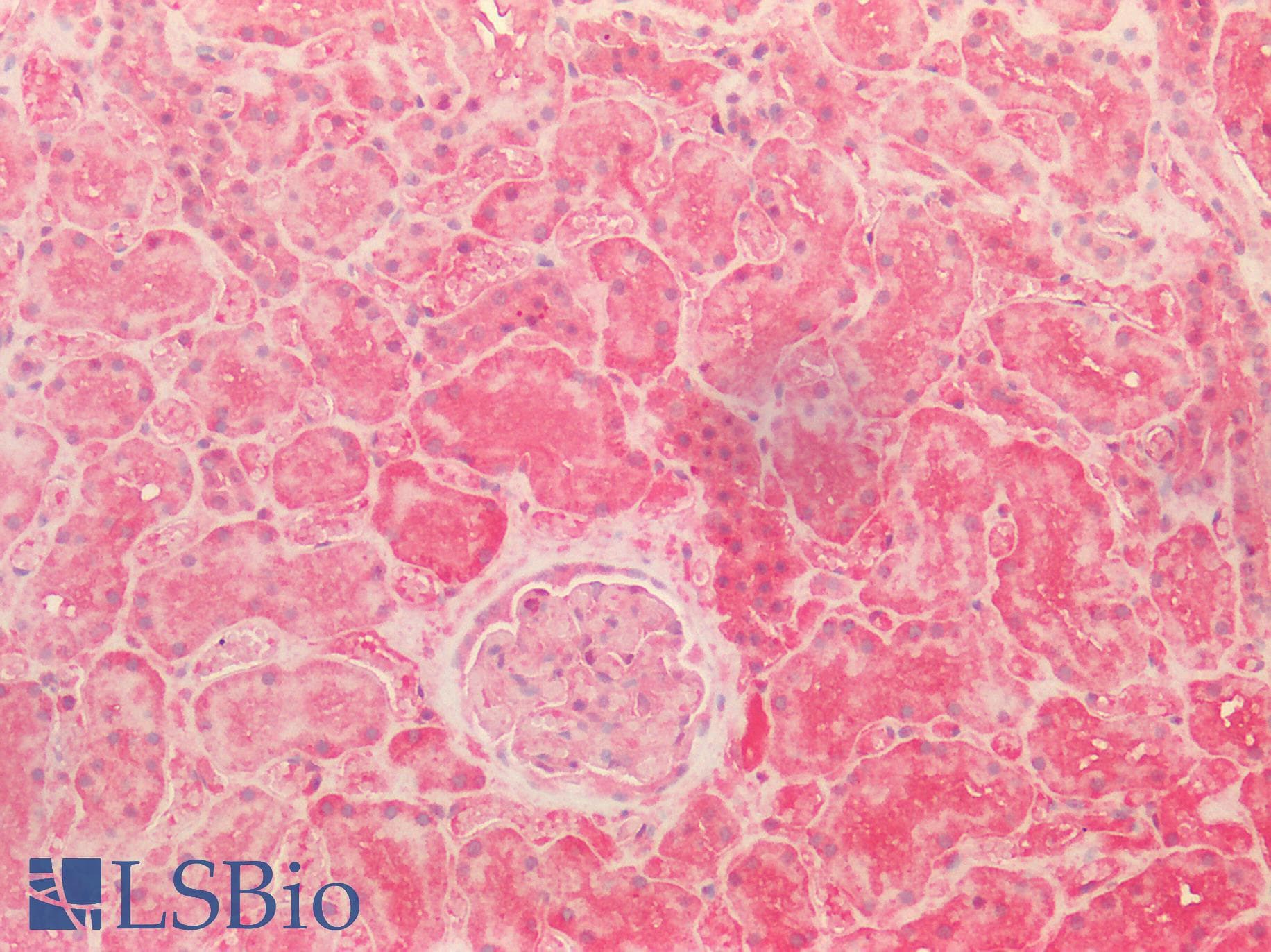 Polyclonal Rabbit anti-Human S100 Protein Antibody (IHC, IF, WB)
