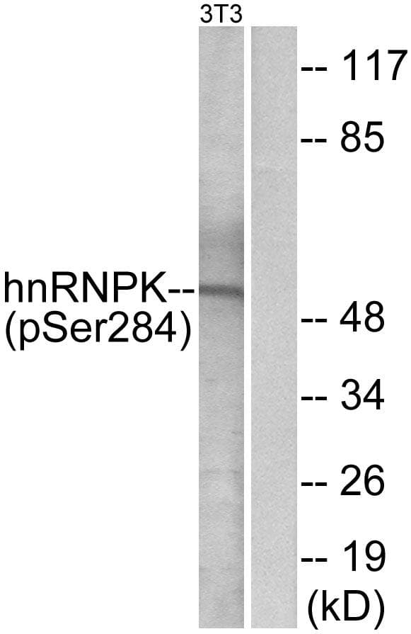 HNRNPK / hnRNP K Antibody (phospho-Ser284)