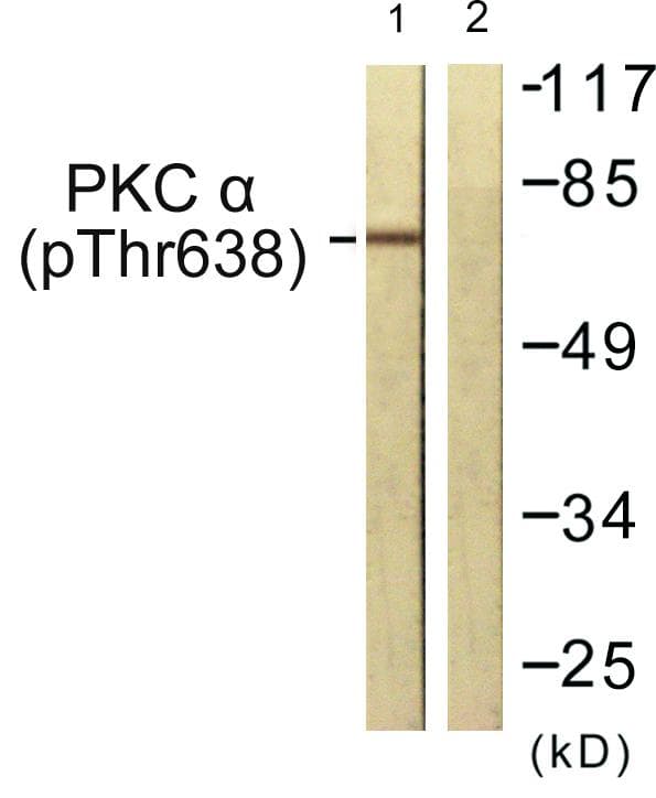 PRKCA / PKC-Alpha Antibody (phospho-Thr638)