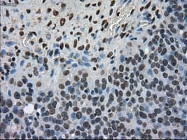 Monoclonal Mouse anti-Human MKI67 / Ki67 Antibody (clone OTI3D11, IHC, WB)