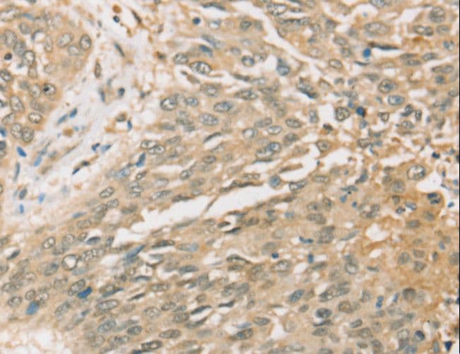 Polyclonal Rabbit anti-Human SIGLEC15 Antibody (IHC)