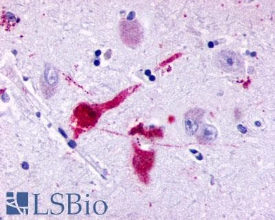 PathPlus™ Polyclonal Rabbit anti-Human P2RY8 / P2Y8 Antibody (Cytoplasmic Domain, IHC)
