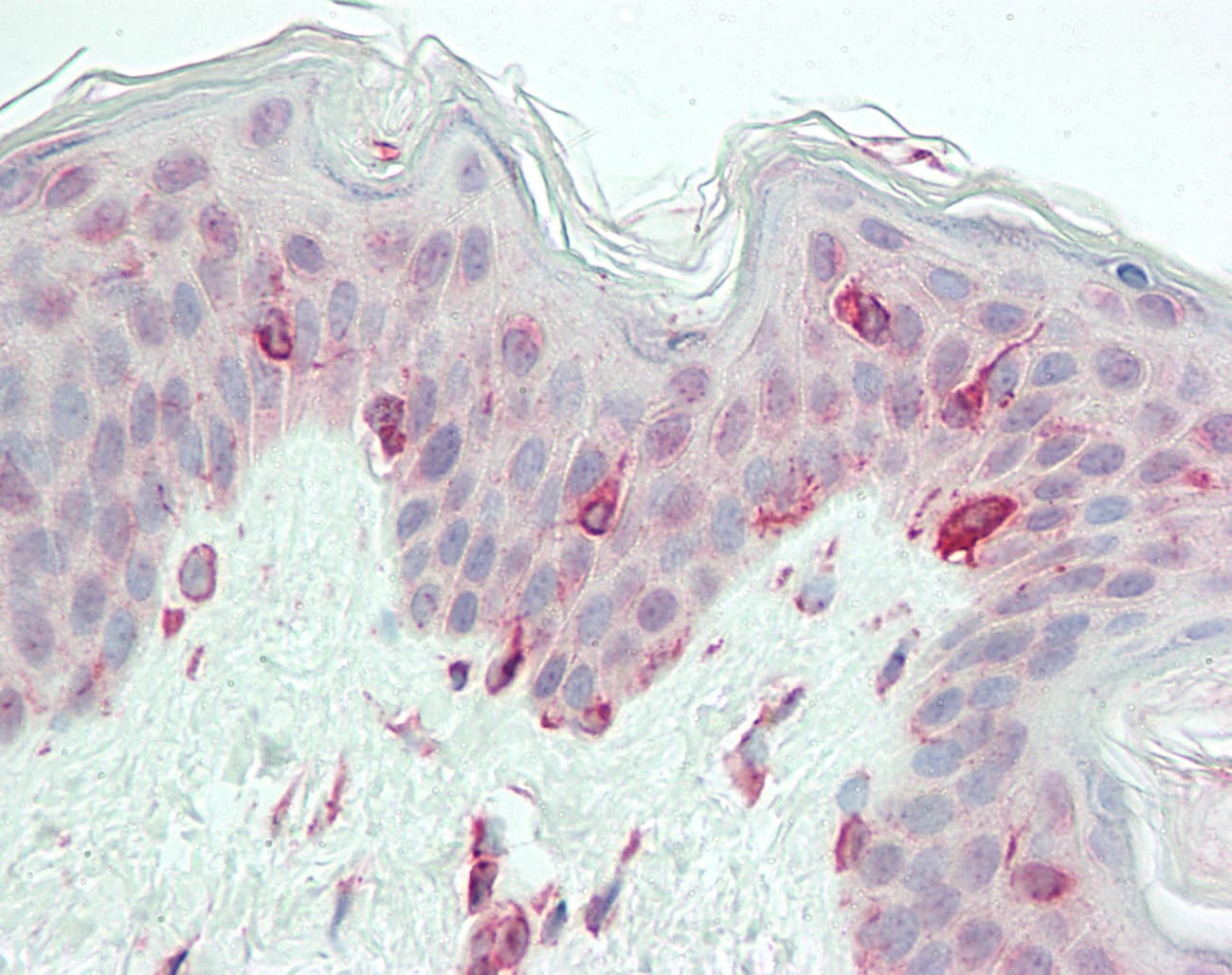 Polyclonal Rabbit anti-Human TRIP / LRRFIP1 Antibody (aa35-84, IHC, WB)