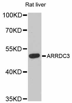 Polyclonal Rabbit anti-Human ARRDC3 Antibody (WB)