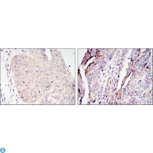 CRTC2 / TORC2 Antibody