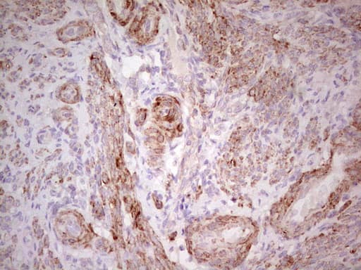 CSNK1G1 / CKI-Gamma 1 Antibody (aa163-422, clone OTI1D7)