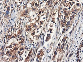 ENPEP / Aminopeptidase A Antibody (clone OTI3E7)