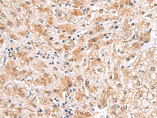 PDCL2 Antibody