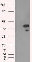 p66 / SHC Antibody (clone OTI3H1)