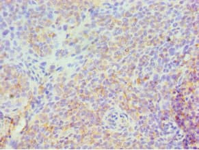 SPN / CD43 Antibody (aa276-400)