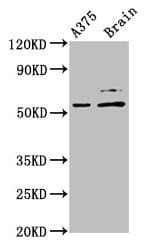 PRAME Antibody (aa1-509)