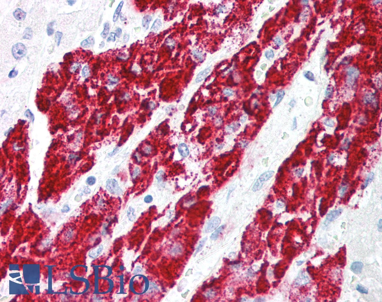 IHC-plus™ IER3 / IEX-1 Antibody
