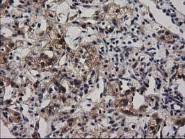 ADSL / Adenylosuccinate Lyase Antibody (clone OTI2D10)