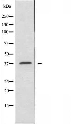 CYSLTR1 / CYSLT1 Antibody