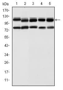 IHC-plus™ BMPR2 Antibody (clone 1F12)