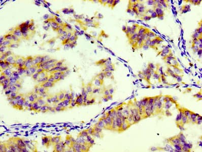 CD74 / CLIP Antibody